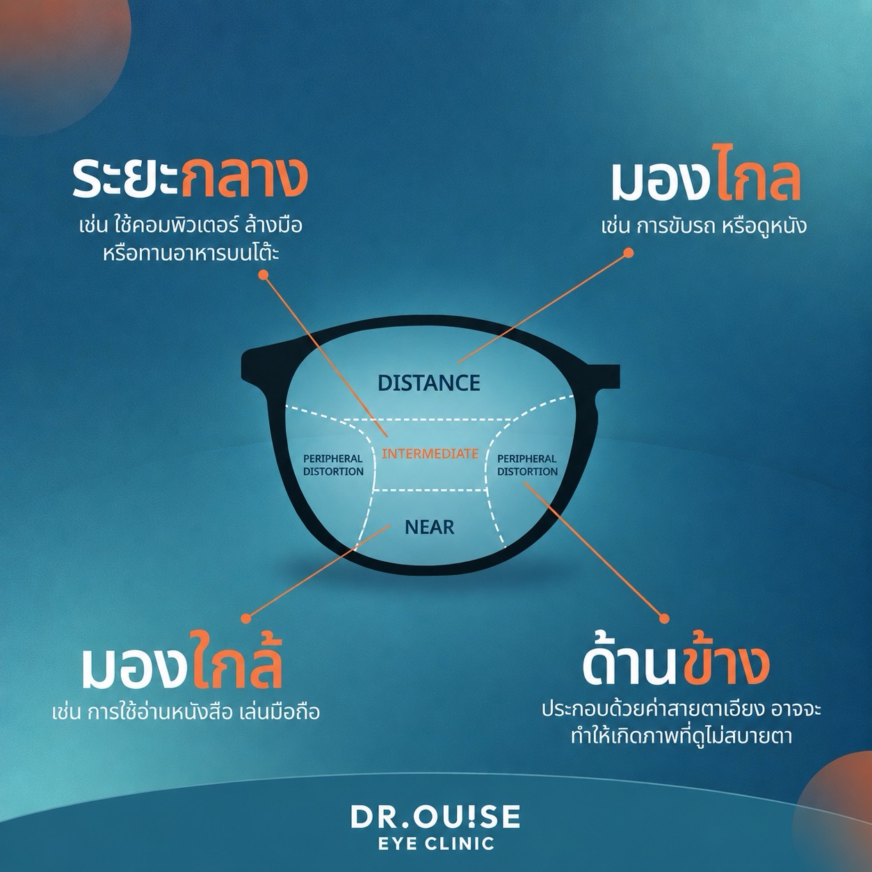 เลนส์โปรเกรสซีฟ คืออะไร Dr.Ouise Eye Specialist
