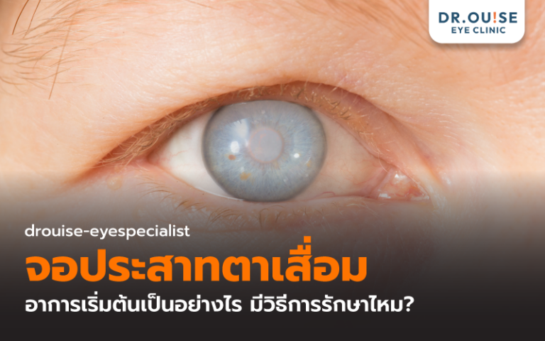 จอประสาทตาเสื่อม อาการเริ่มต้นเป็นอย่างไร มีวิธีการรักษาไหม?
