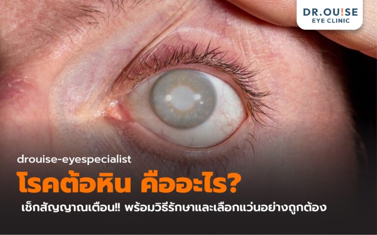 โรคต้อหิน คืออะไร? เช็กสัญญาณเตือน พร้อมวิธีรักษา