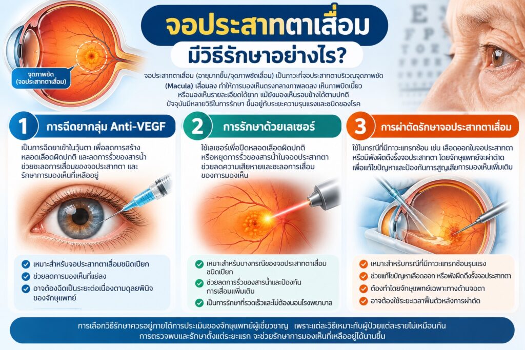 จอประสาทตาเสื่อม อาการเริ่มต้นเป็นอย่างไร มีวิธีการรักษาไหม?
